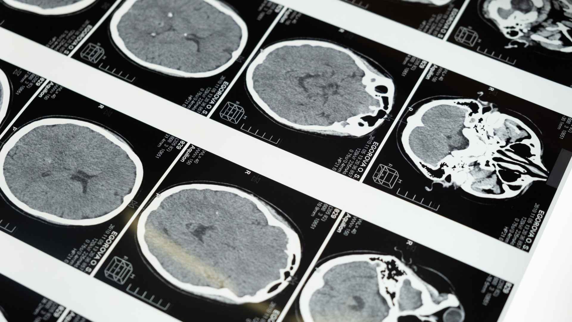 Cuenta UANL con clínica especializada en atención de Alzheimer