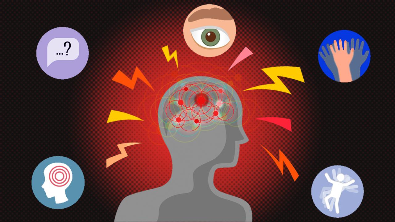 Enfermedad vascular cerebral, un problema por atender en México