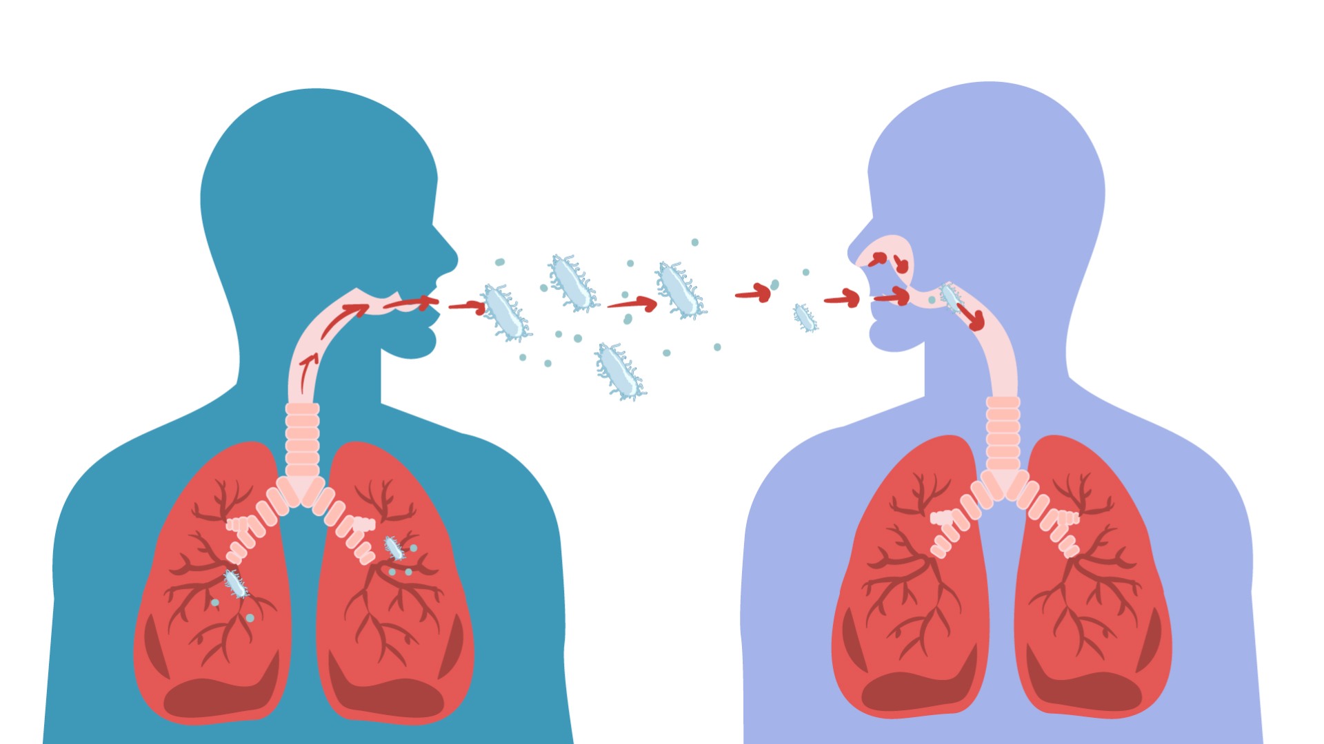 Piden precaución ante exposición a tuberculosis